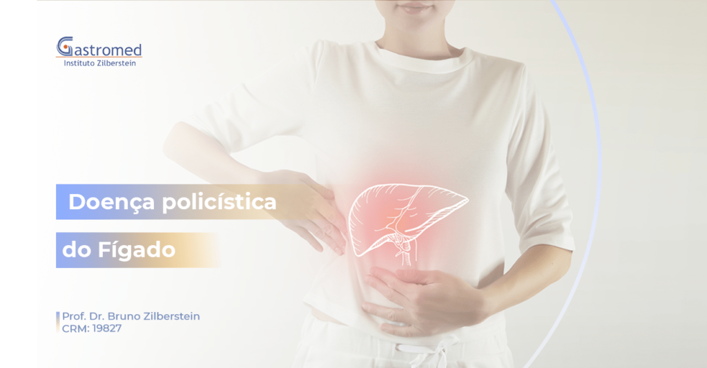 Doença Policística do Fígado | Gastromed