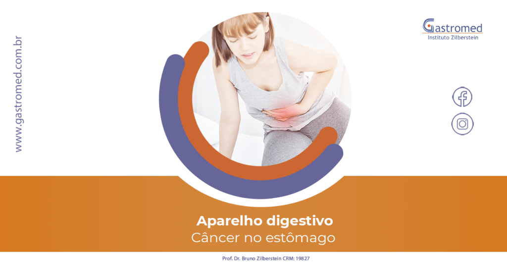 Câncer de estômago | Gastromed