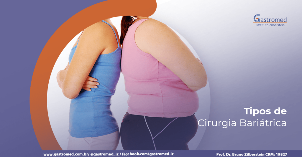 Tipos de bariátrica | Gastromed