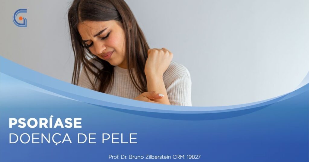 Psoríase | Gastromed