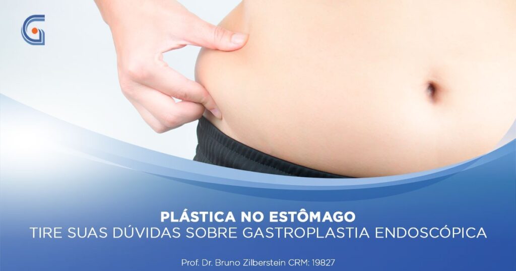Gastroplastia Endoscópica | Gastromed