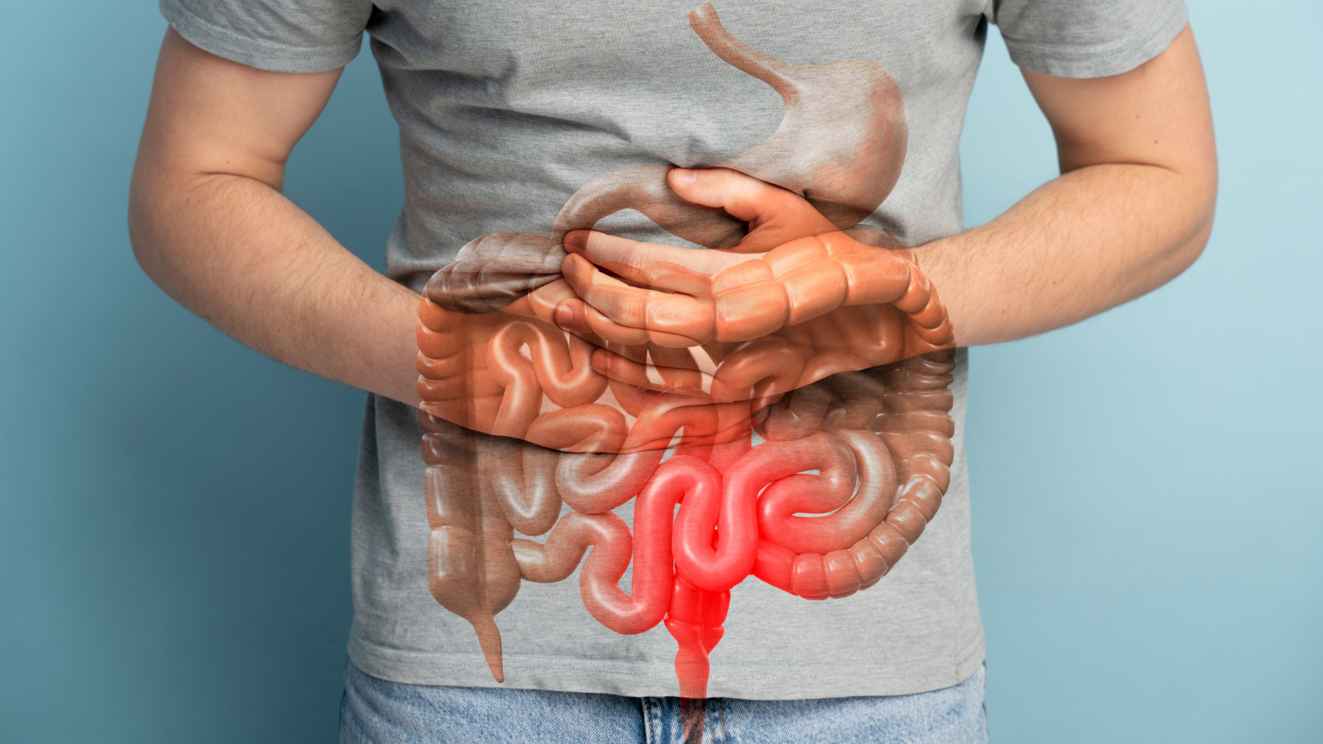 Diverticulite 7 Sintomas, Causas e Tratamentos da Inflamação Intestinal | Gastromed