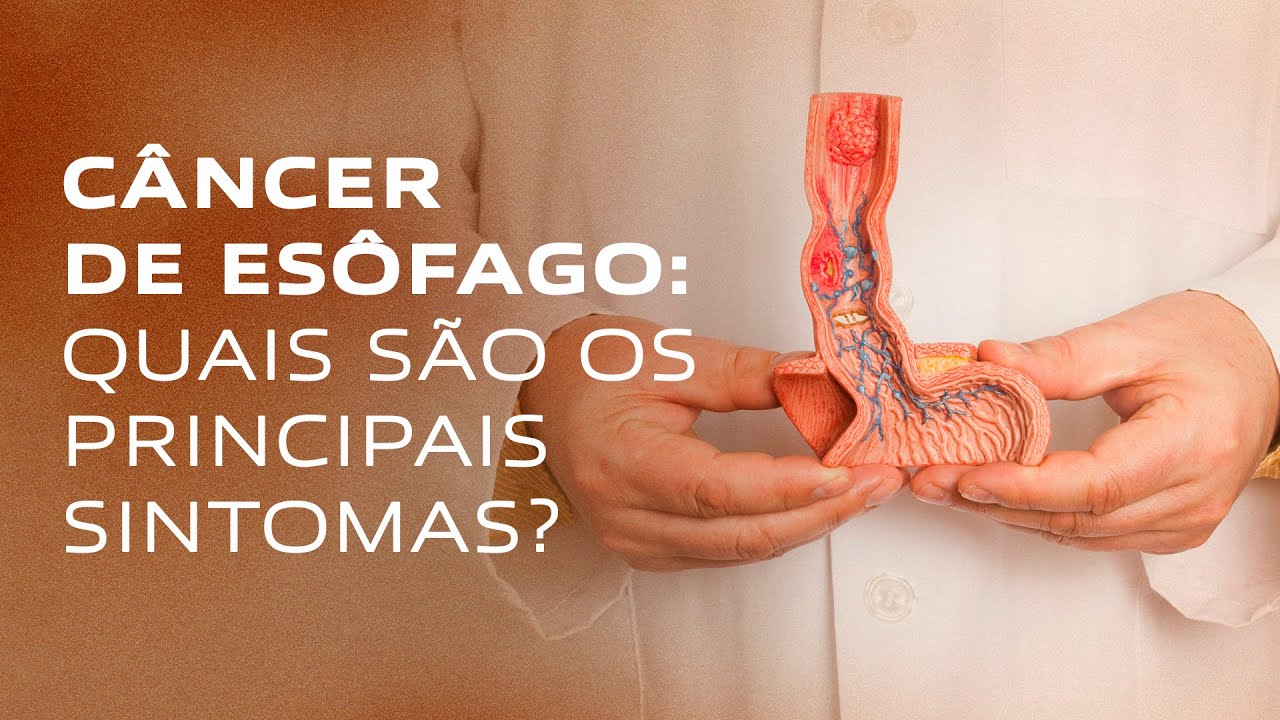 Câncer de Esôfago: 7 Sintomas, Fatores de Risco e Diagnóstico Precoce | Gastromed